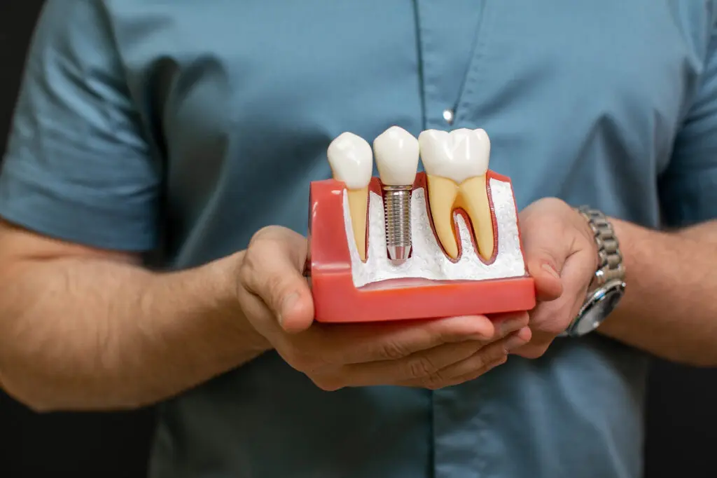 Dental Implants in Okemos, MI